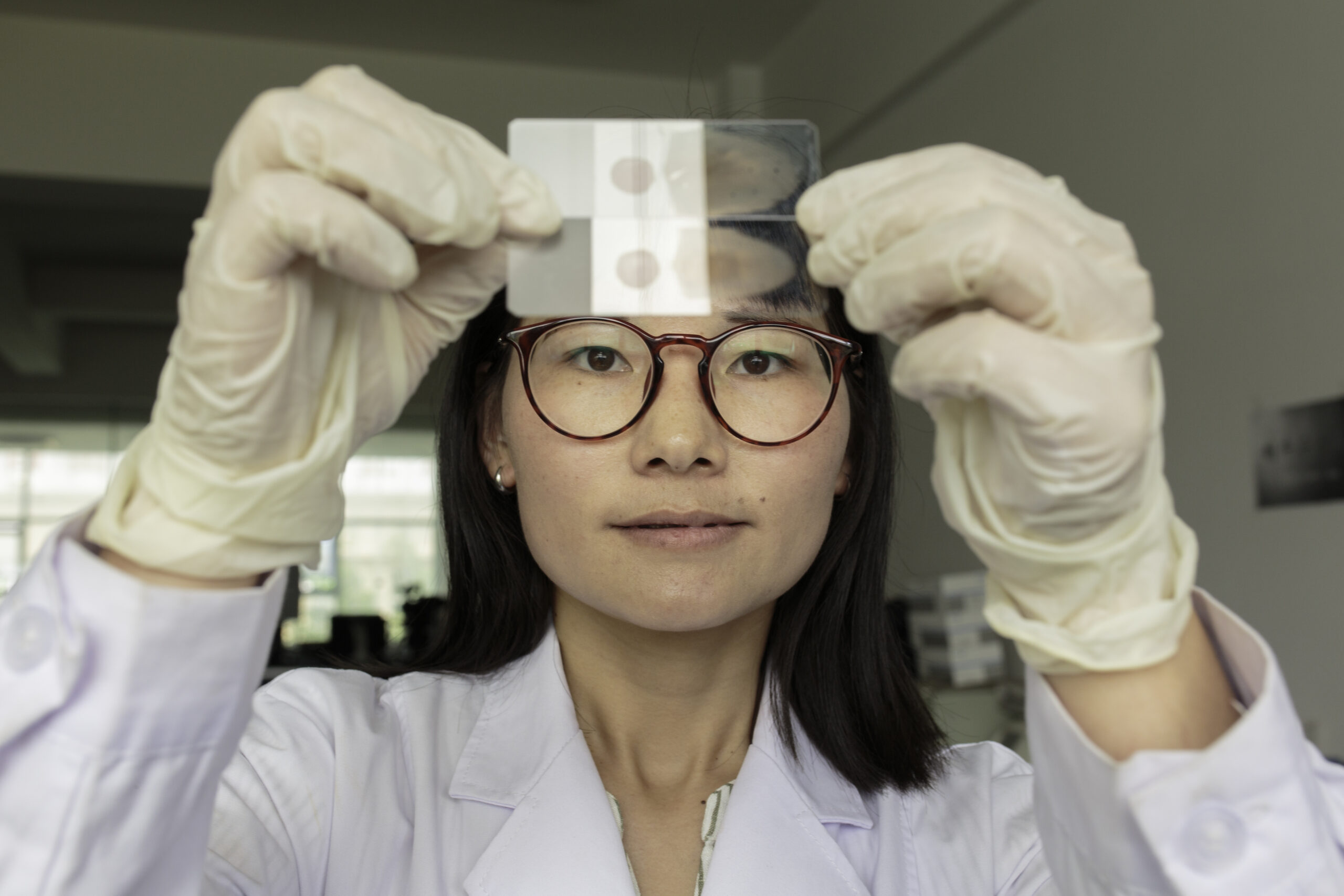 Xu Yanchun, a laboratory specialist, holds blood smears that she will examine for malaria parasites. Rapid diagnosis of malaria is a key aspect of the “1-3-7” strategy. Yunnan Institute for Parasitic Diseases, Pu'er Simao, Yunnan. April 2019.